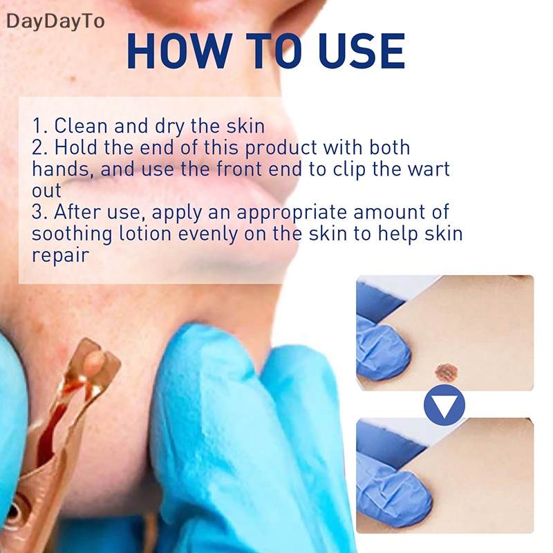 1 Dụng Cụ Kẹp Nhỏ Bằng Đồng Loại Bỏ Mụn Cóc Hình Xăm