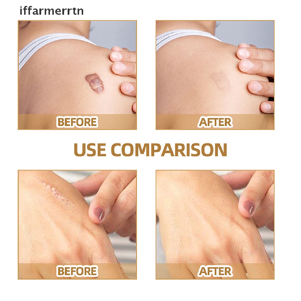 Bộ 60 Miếng Dán Che Khuyết Điểm Hình Xăm Chống Nước Che Phủ Mỏng