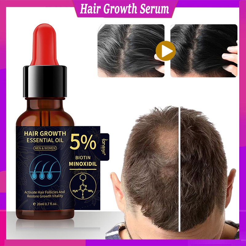 Serum Kích Thích Mọc Tóc 5% Minoxidil Chiết Xuất Gừng Dành Cho Nam Và Nữ