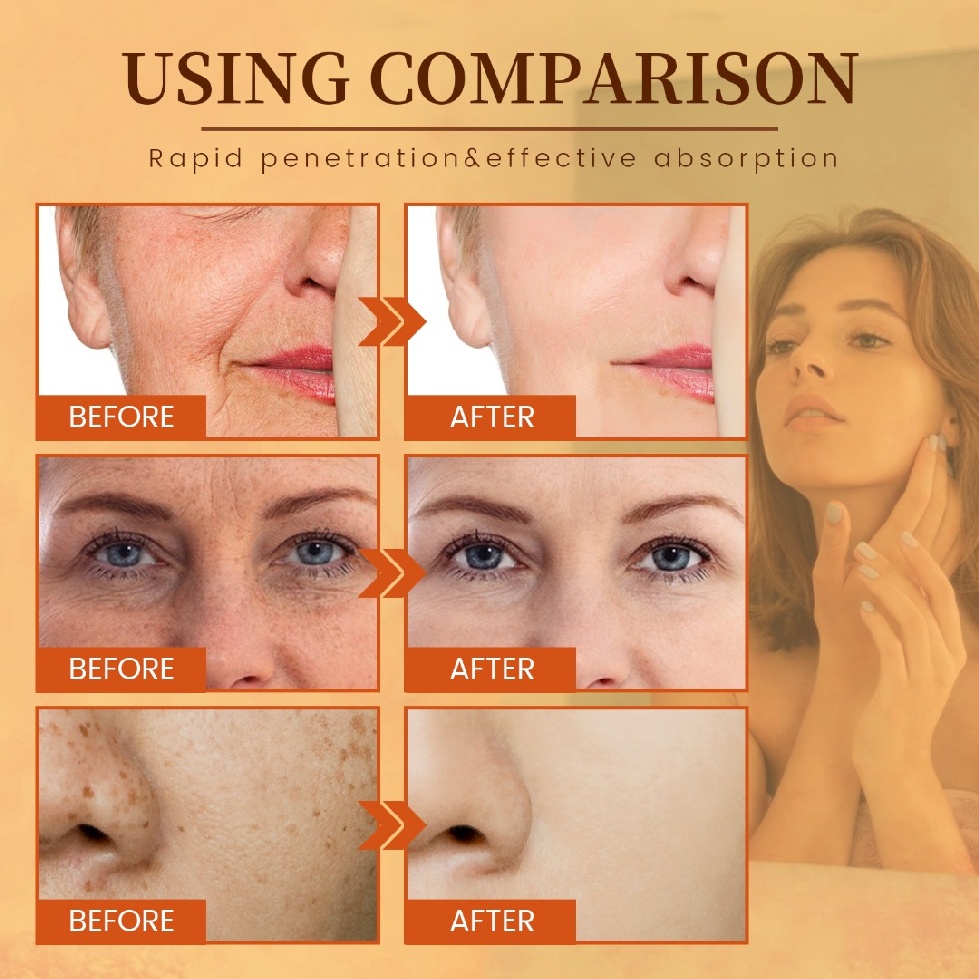 Vitamin C Freckle Removing Night Serum Whitening Brightening Dark Spot Remover