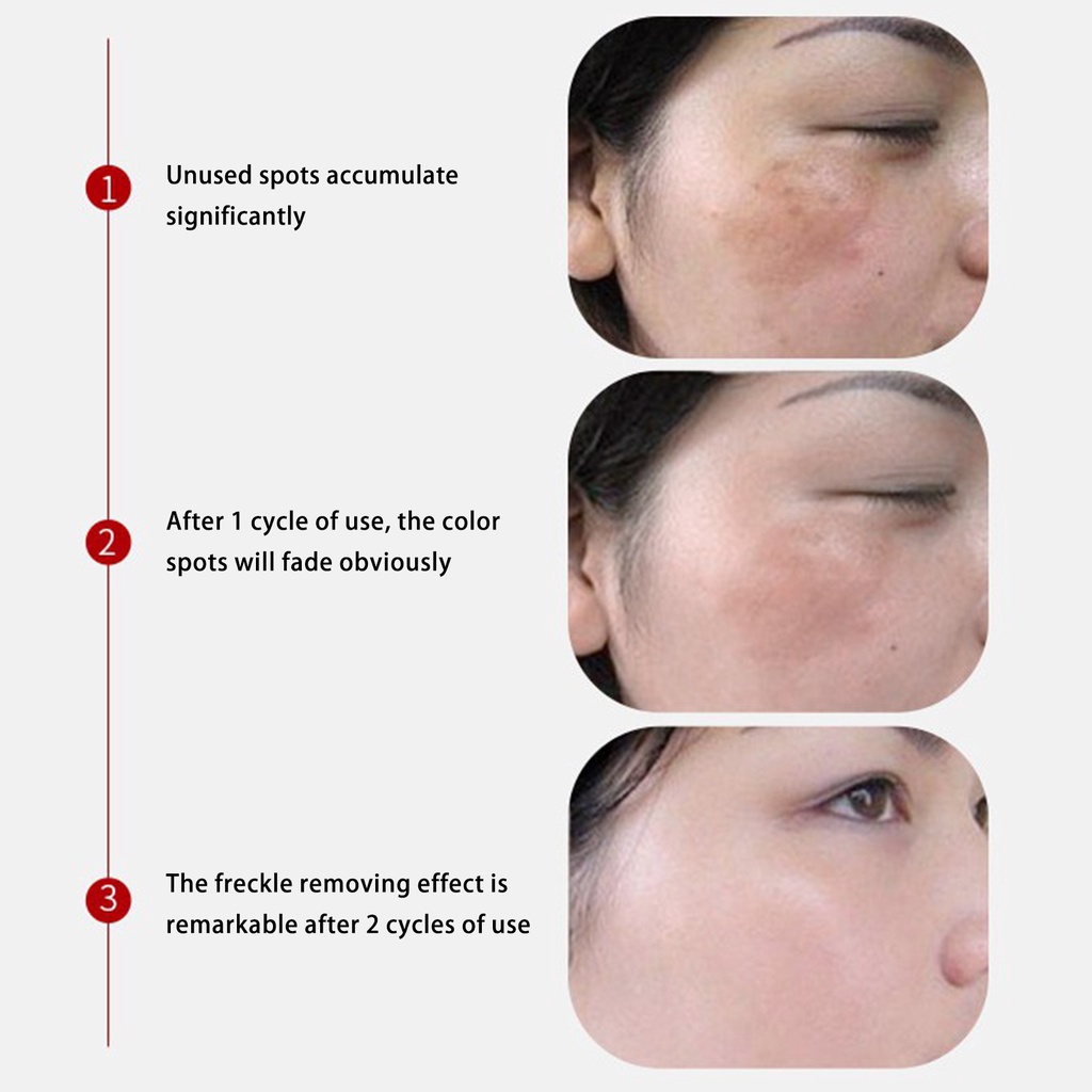 Kem Làm Trắng Da 20g Giúp Xóa Mờ Vết Thâm Hiệu Quả