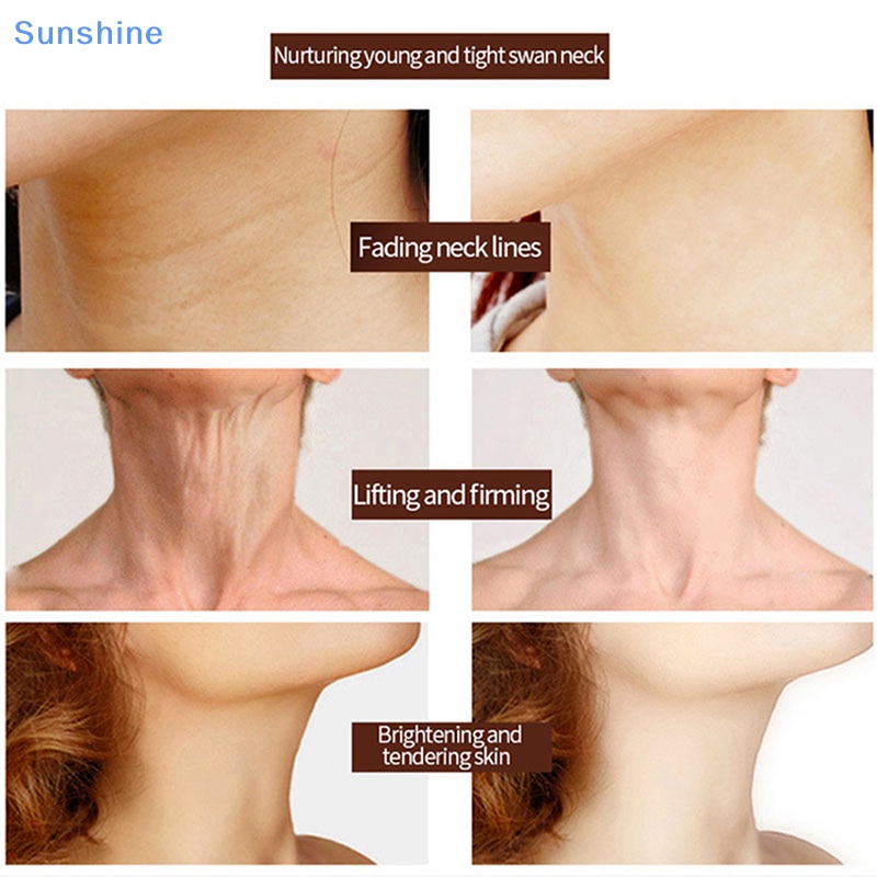 Kem Dưỡng Da Cổ 30ML Tinh Chất Collagen Dưỡng Ẩm Xóa Mờ Nếp Nhăn Hỗ Trợ Làm Trắng