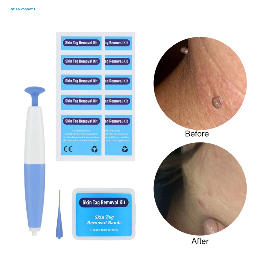 Túi Đựng Đồ Dùng Cao Cấp Tiện Dụng| 1 Bộ Dụng Cụ Loại Bỏ Mụn Cóc An Toàn Không Gây Kích Ứng Chăm Sóc Da Nhanh Chóng An Toàn Thân Thiện Với Làn Da