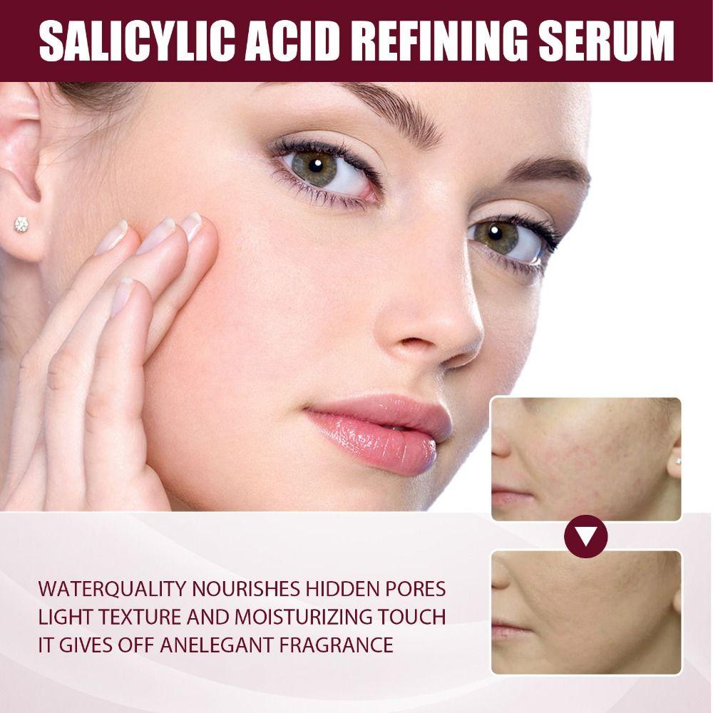 Tinh Chất Axit Salicylic Trái Cây Giúp Làm Trắng Và Tẩy Tế Bào Chết Cho Da