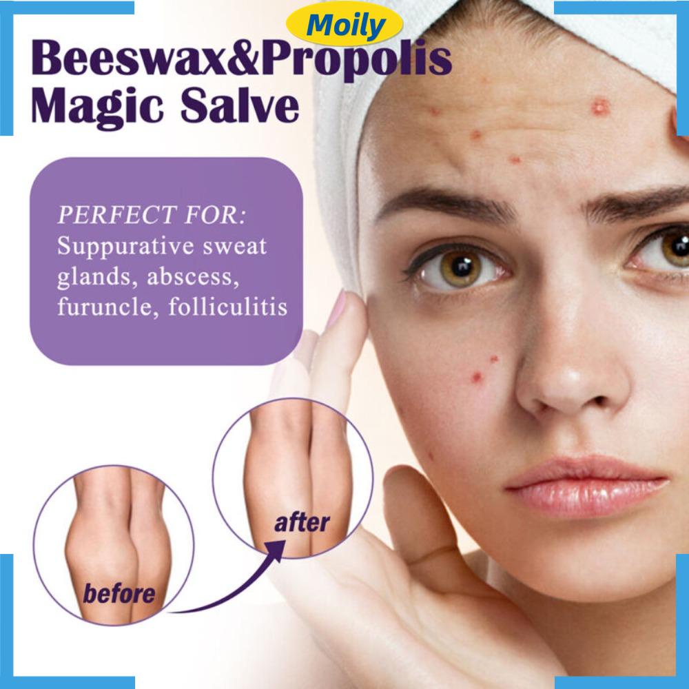 Keo Ong Dạng Lưới Chăm Sóc Da Mặt Dịu Nhẹ