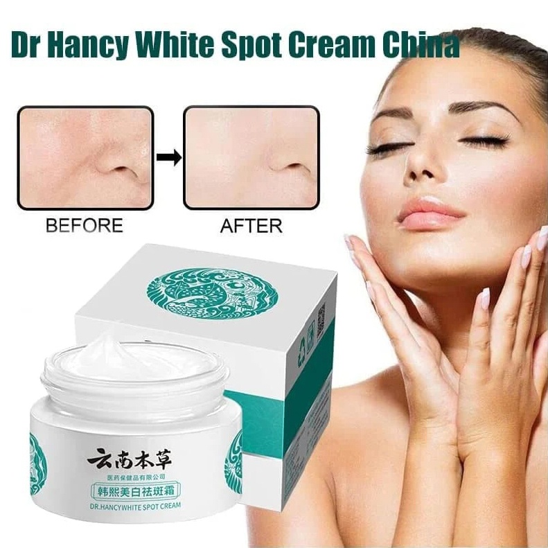 Whitening Spot Freckle Cream Dark Spots Corrector Melasma Remover for Face Skin
