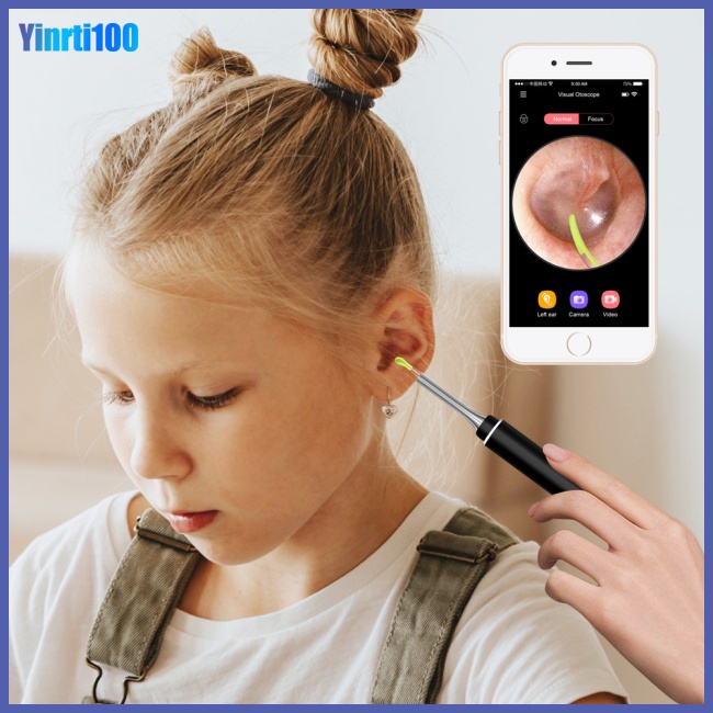 Camera Nội Soi Vệ Sinh Tai Không Dây Thông Minh 300w Kết Nối Wifi