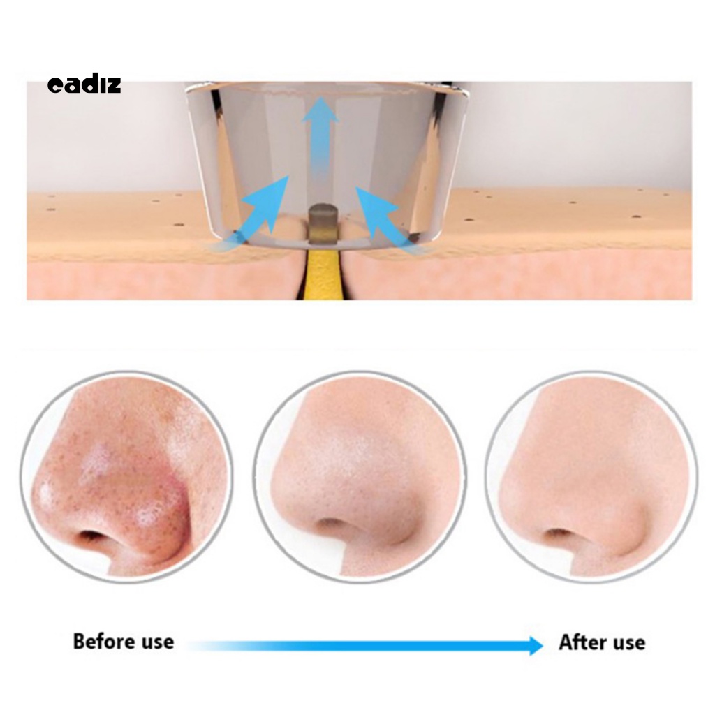 Máy Hút Mụn Đầu Đen Làm Sạch Lỗ Chân Lông Cầm Tay Sạc Điện Bằng Nhựa ABS Dành