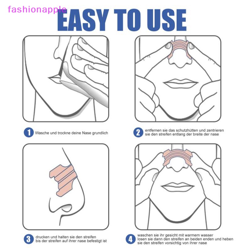 Set 10 Dải Dán Mũi Chống Ngáy Tiện Dụng Chất Lượng Cao