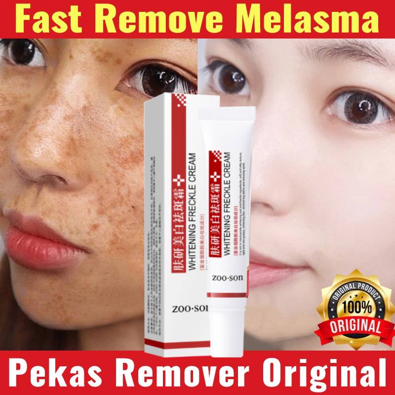 Kem Trị Nám Tẩy Collagen Nhật Bản Tẩy Gốc & Tàn Nhang Kem Tẩy Tàn Nhang Mặt 20G Vết Thâm Tẩy Trang AubessDS