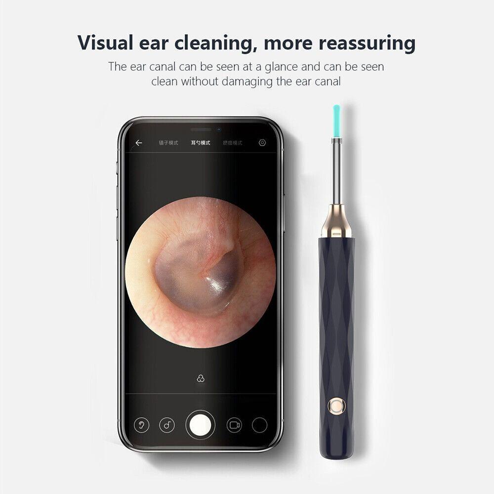 BSUNS Dụng Cụ Lấy Ráy Tai Thông Minh Không Dây Có Camera Chăm Sóc Sức Khỏe