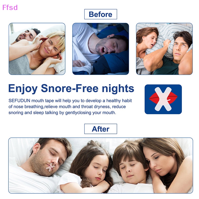 {Ffsd} Set 60 Miếng Dán Miệng Chống Ngáy Khi Ngủ Cải Thiện Giấc Ngủ Ban Đêm * Bán Chạy