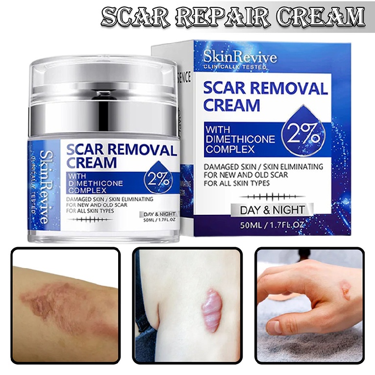 50ml Scar Removal Cream Skin Repair Body Acne Stretch Marks Remover Gel