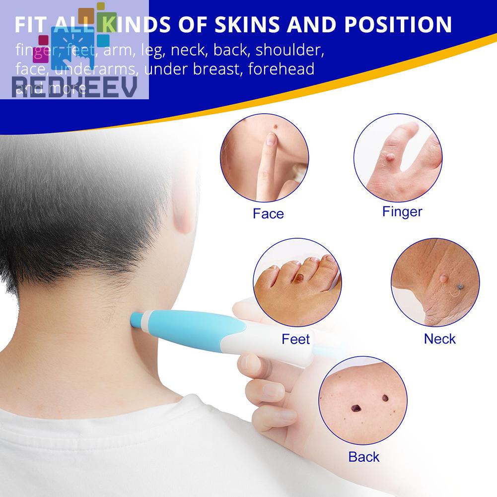 Bộ Bút Tẩy Mụn Không Đau Trọng Lượng Nhẹ Nhanh Chóng Chăm Sóc Da