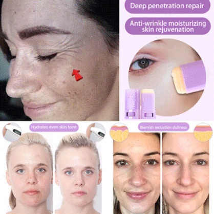 Tinh Dầu Rắn Nicor Chăm Sóc Da Cổ