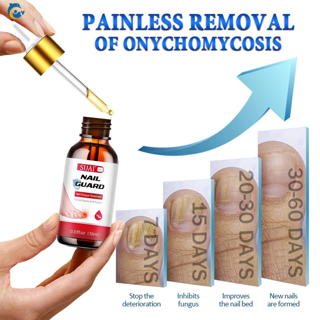 10ml Móng Tay Điều Hỗ trợ giảm nấm Serum Chống Nhiễm Trùng Paronychia Onychomycosis Loại Bỏ Ngón Chân Nấm Bàn Tay Sửa Chữa Gel Chăm Sóc Serum