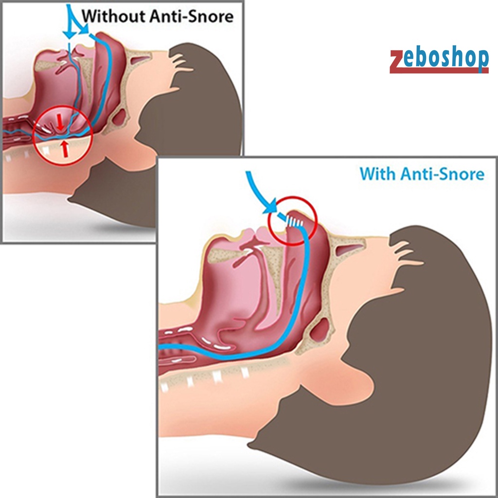 Kẹp Chống Ngáy Mini Bằng PE Tiện Dụng Cho Gia Đình