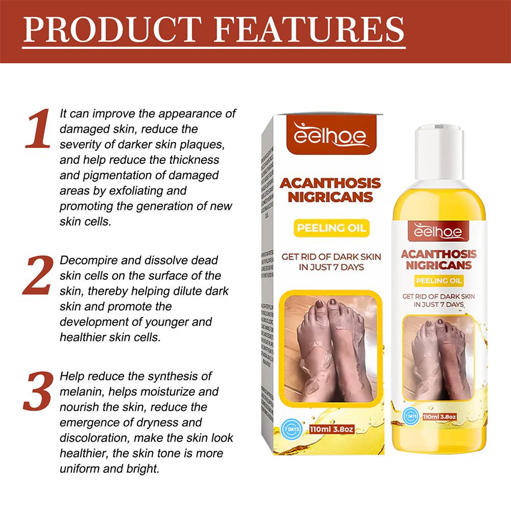 Tinh Dầu Acanthosis Nigricans 110ml Tẩy Tế Bào Chết Dưỡng Ẩm Nuôi Dưỡng Da A5N9