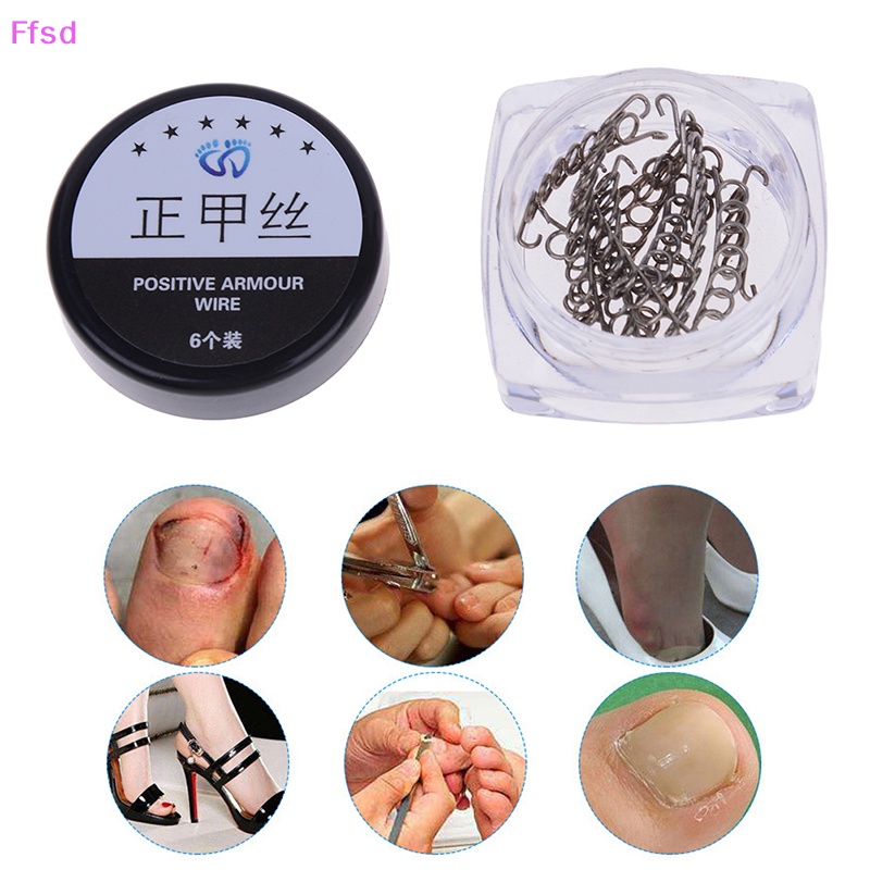 Bộ 6 Dụng Cụ Chỉnh Sửa Móng Chân Mọc Ngược Tiện Dụng