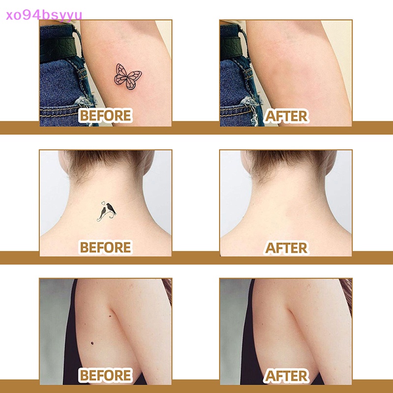 Set 60 Miếng Dán Che Khuyết Điểm Hình Xăm / Vết Sẹo / Vết Sẹo Không Thấm Nước Xo94Bs