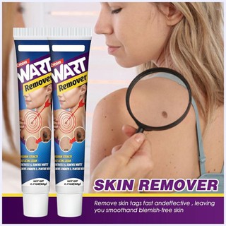 Kem trị mụn cóc Kem trị mụn cóc Kem trị mụn cóc Kem trị mụn cóc nốt ruồi No Trace Care Cream
