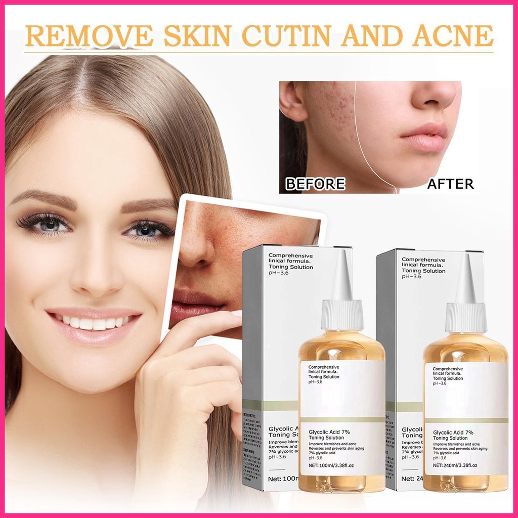 Toner Glycolic Acid Glycolic Acid 7 Tẩy Tế Bào Chết Cho Da Mặt 100ml / 240ml