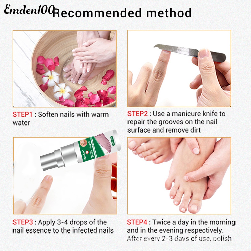 Dung Dịch Kháng Khuẩn 10ml Dễ Sử Dụng Cho Chăm Sóc Móng Tại Nhà