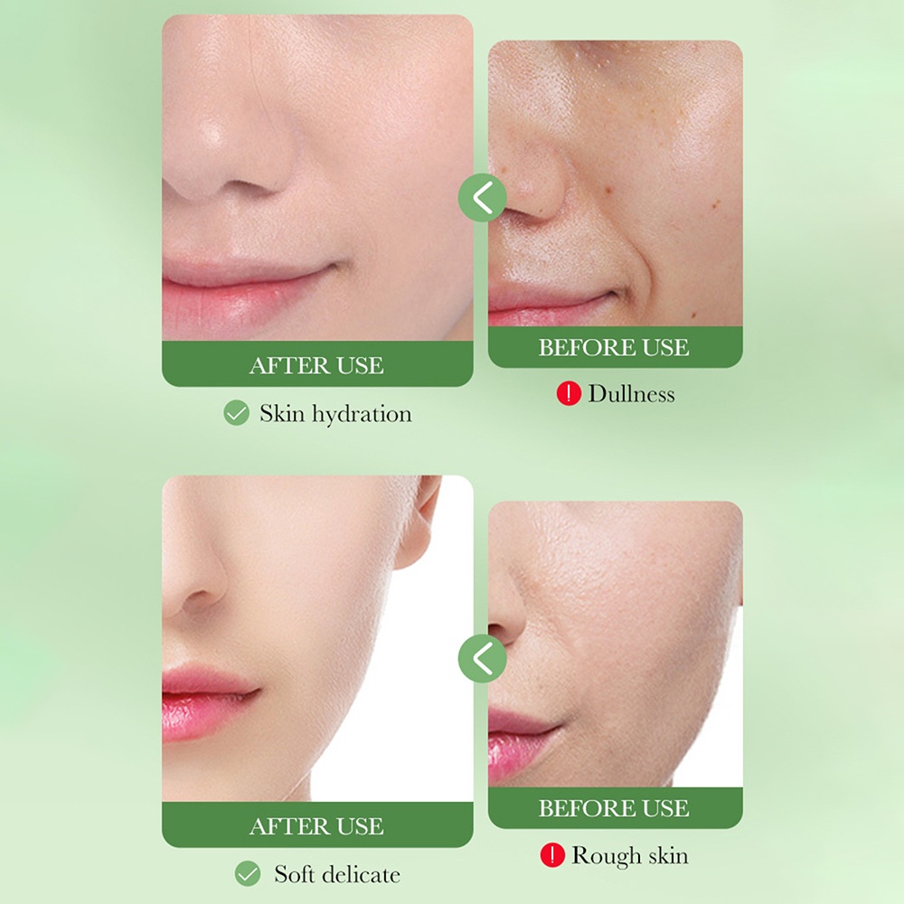 Serum BIOAOUA Centella Asiatica Làm Sạch Sâu Chống Lão Hóa Dưỡng Ẩm Làm Săn Chắc Da Mặt