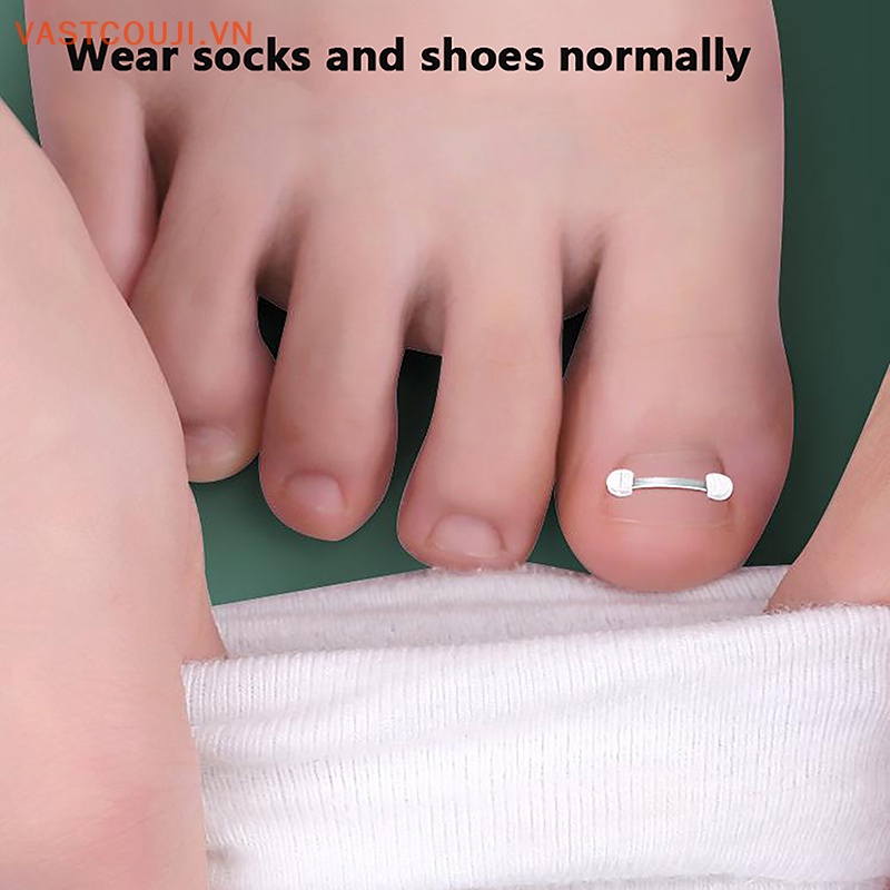 Kẹp Co Giãn Chỉnh Sửa Móng Chân Bị Cong Vnstji