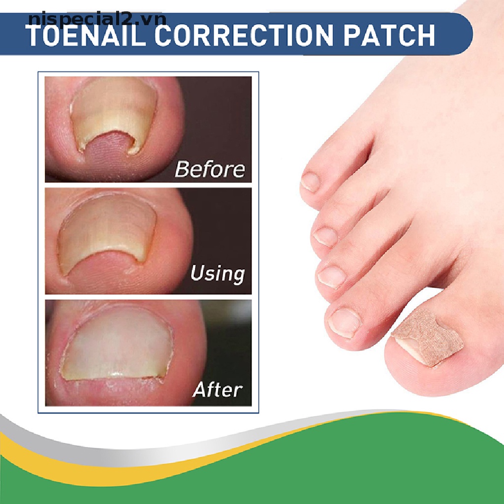 Set 50 Miếng Dán Chỉnh Sửa Móng Chân Tiện Dụng