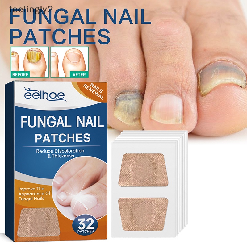 Bộ 32 Miếng Dán Chỉnh Sửa Chữa Móng Chân An Toàn