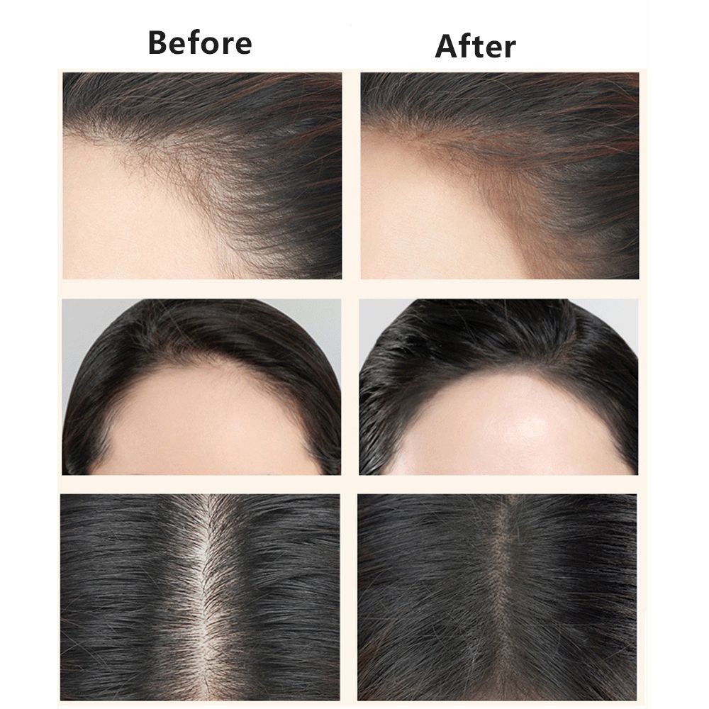 Phấn Che Khuyết Điểm Chân Tóc Chống Thấm Nước Màu Sắc Thời Trang