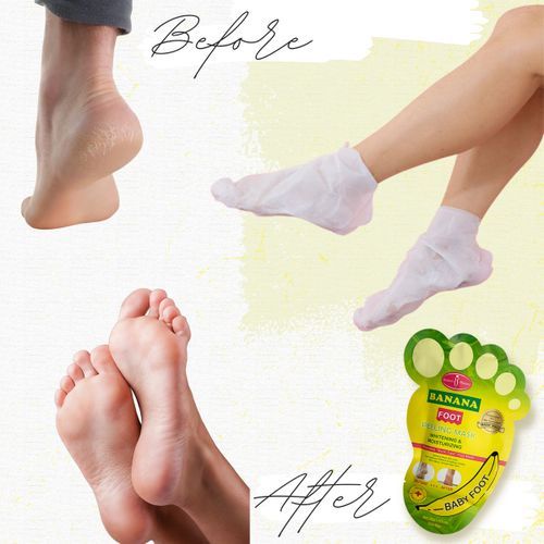Mặt Nạ Ủ Lột Tế Bào Chết Cho Da Chân Chiết Xuất Từ Chuối Aichun Beaty Dưỡng Ẩm, Làm Trắng Sáng, Tẩy Tế Bào Chết Chân