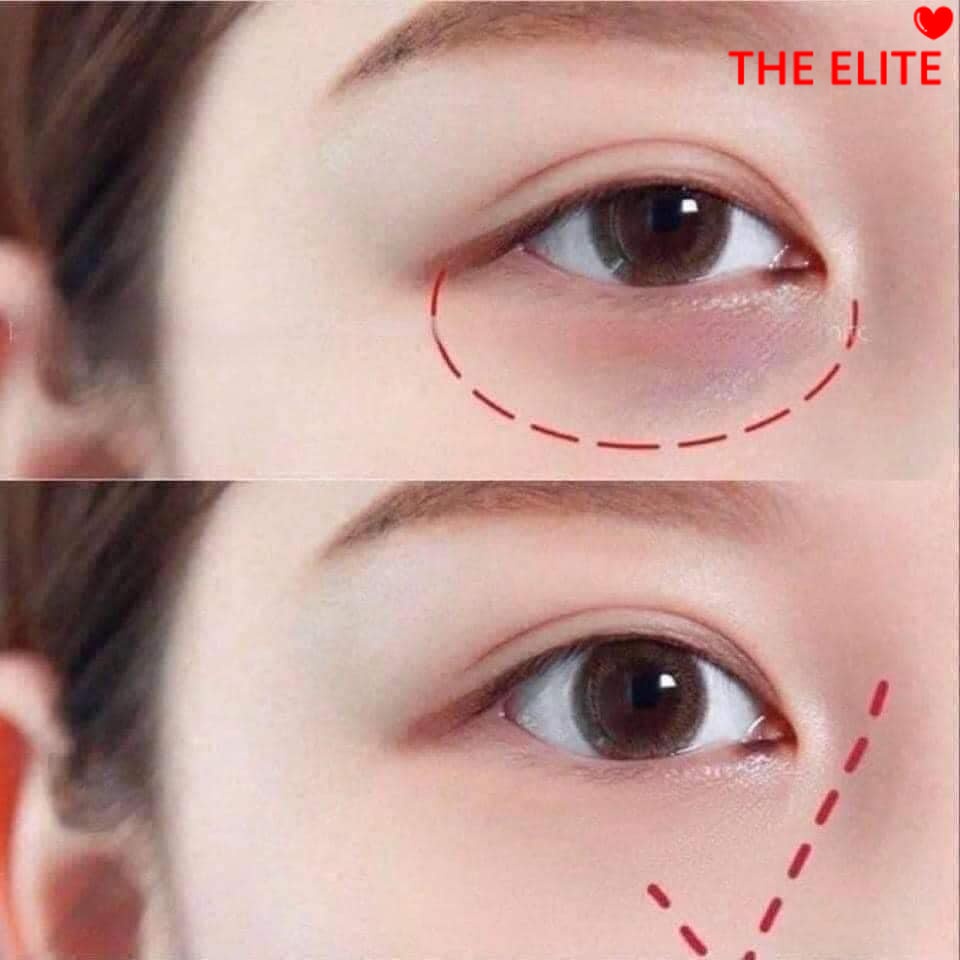 Serum mắt Estee Lauder Advanced Night Repair Eye Concentrate Matrix 5ML NO BOX