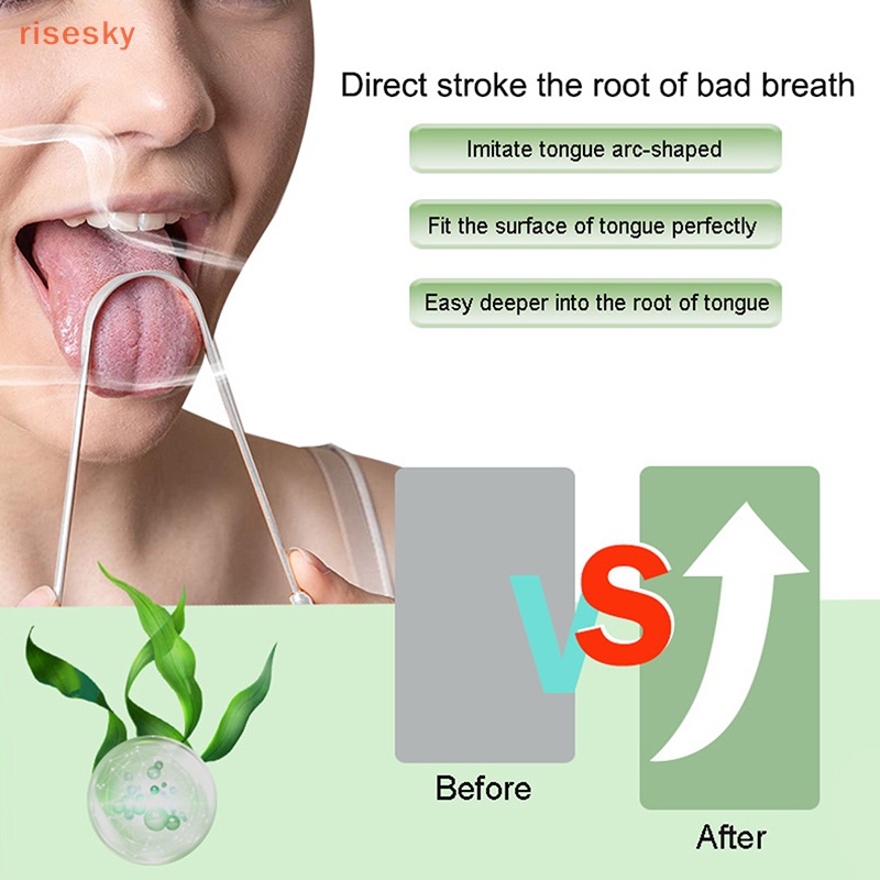 1 Dụng Cụ Vệ Sinh Lưỡi Bằng Thép Không Gỉ