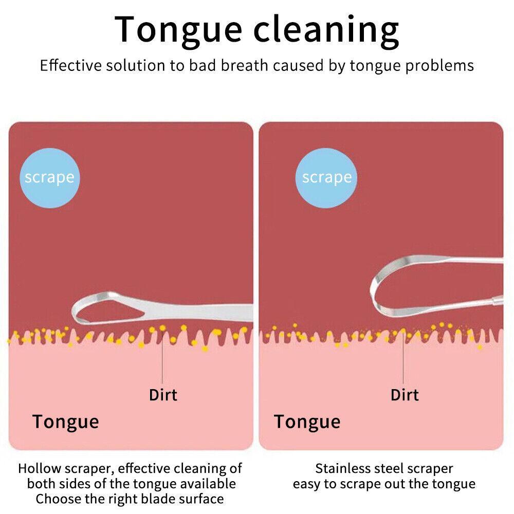 MOILYVN Set 3 Dụng Cụ Nạo Làm Sạch Lưỡi Chăm Sóc Răng Miệng Cho Nữ