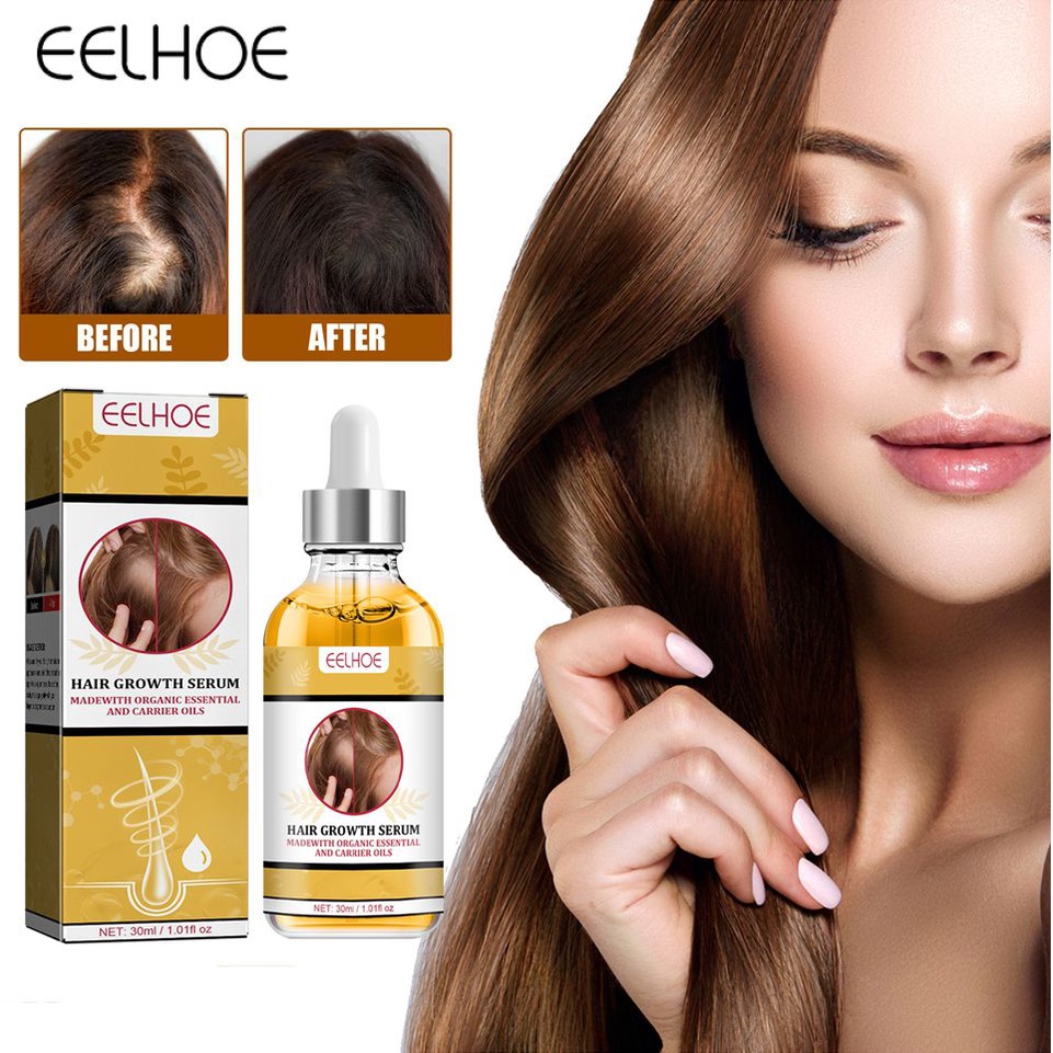 Eelhoe Dung Dịch Mọc Tóc Giúp Chân Tóc Chắc Khỏe Và Dưỡng Ẩm Cải Thiện Dinh Dưỡng Ngăn Ngừa Rụng Tóc Kiên Cố Hóa Và Kéo Dài 30Ml-Ampe