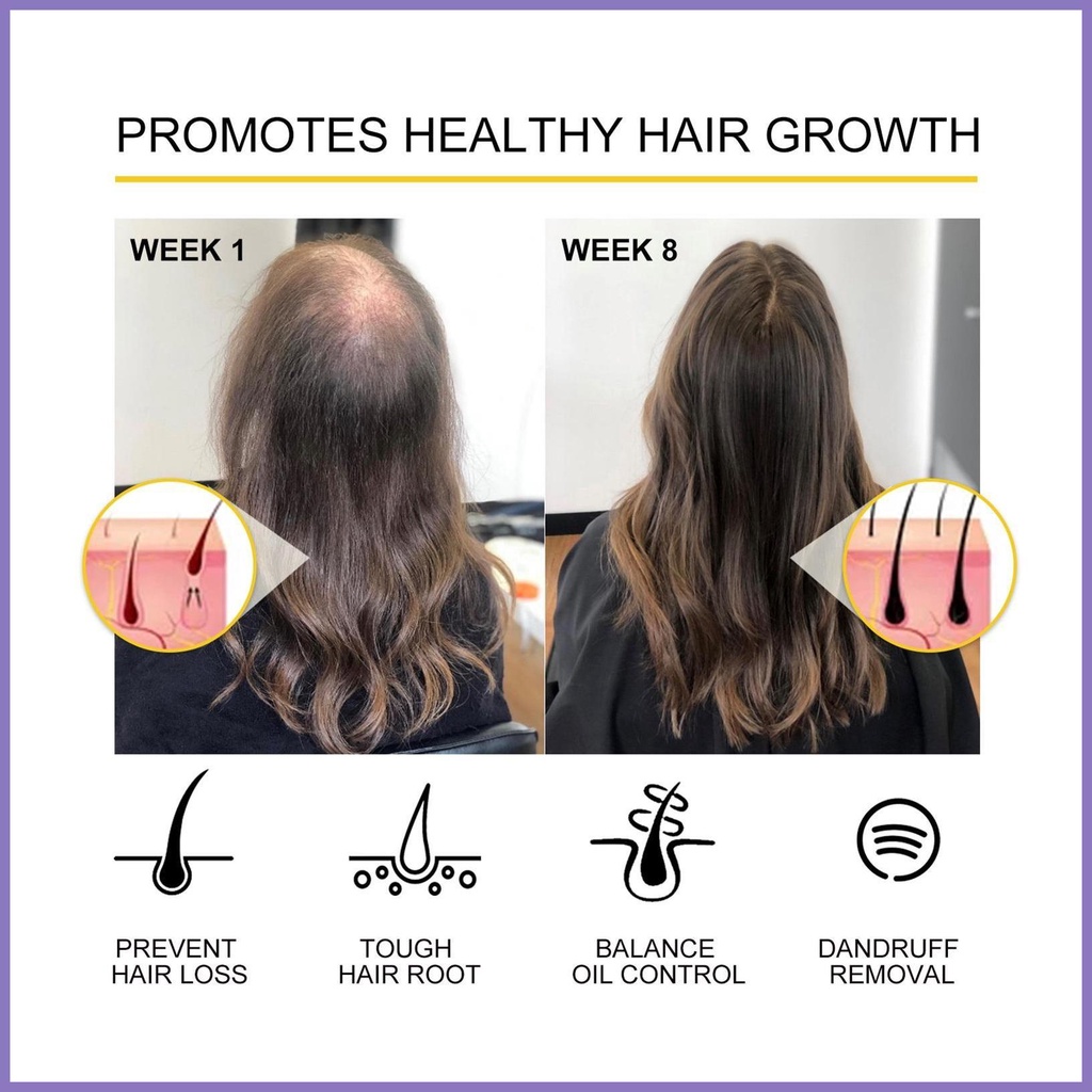 Tinh Chất Kích Thích Mọc Tóc 30ml An Toàn Cho Tóc Dày Hơn Và Rụng Tóc nota2vn