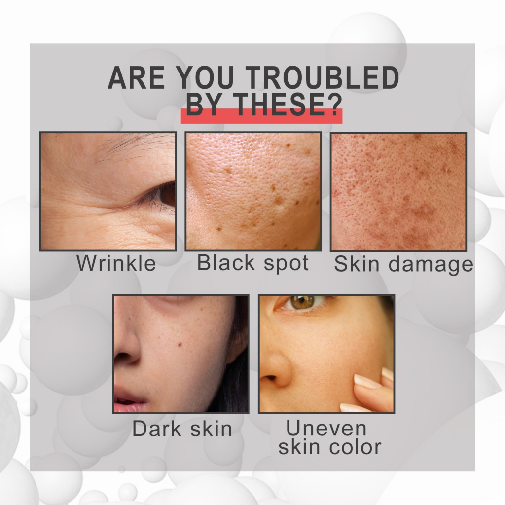 Kem Collagen Hyaluronic Acid Dưỡng Ẩm Làm Săn Chắc Da Chống Nếp Nhăn Lão Hóa