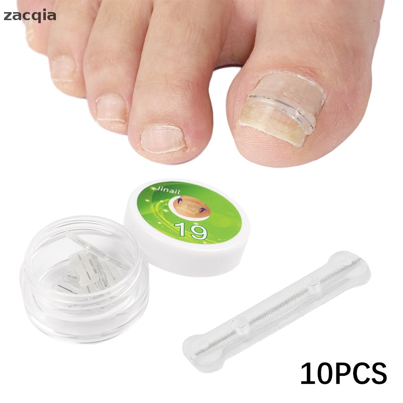 Set 10 Miếng Dán Chỉnh Sửa Móng Chân 13-20mm Tiện Dụng