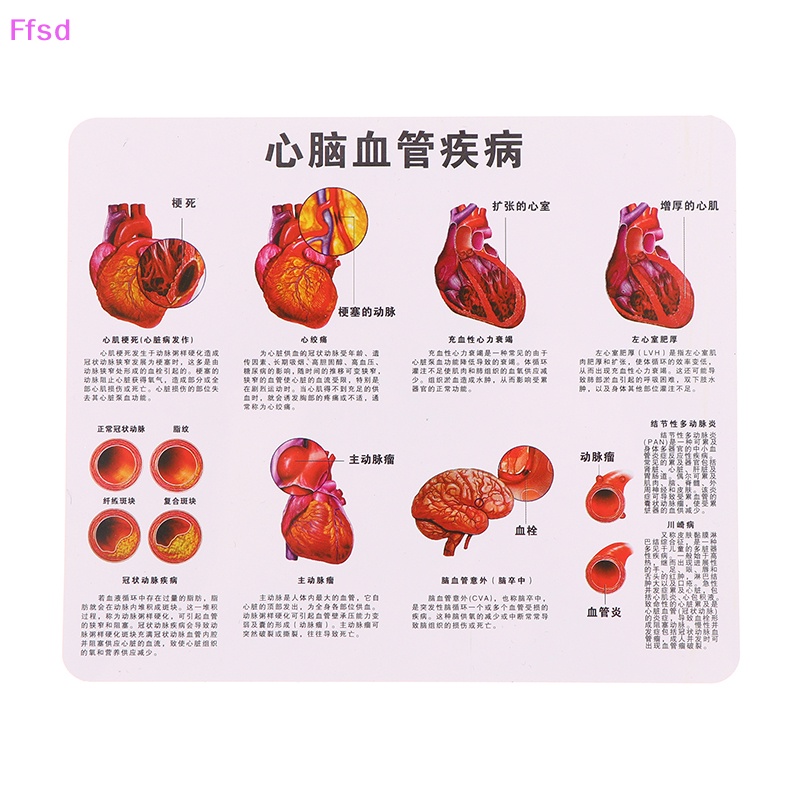 Tượng Vessel Con Người Nối Dài 50 Lần Cho Phòng Thí Nghiệm