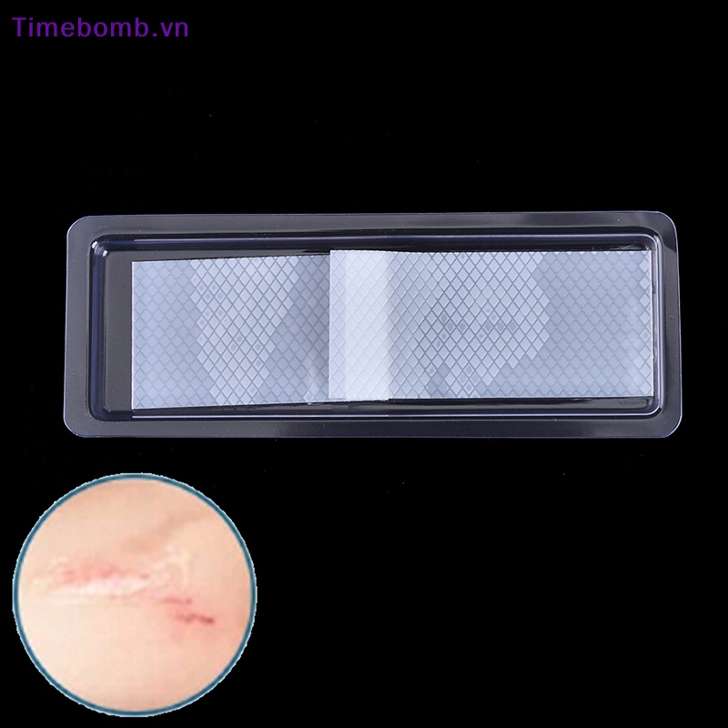 # Túi Đeo Chéo Thời Trang Hàn Cho Nữ # Miếng Dán Silicone Hỗ Trợ Giảm Sẹo Hiệu Quả