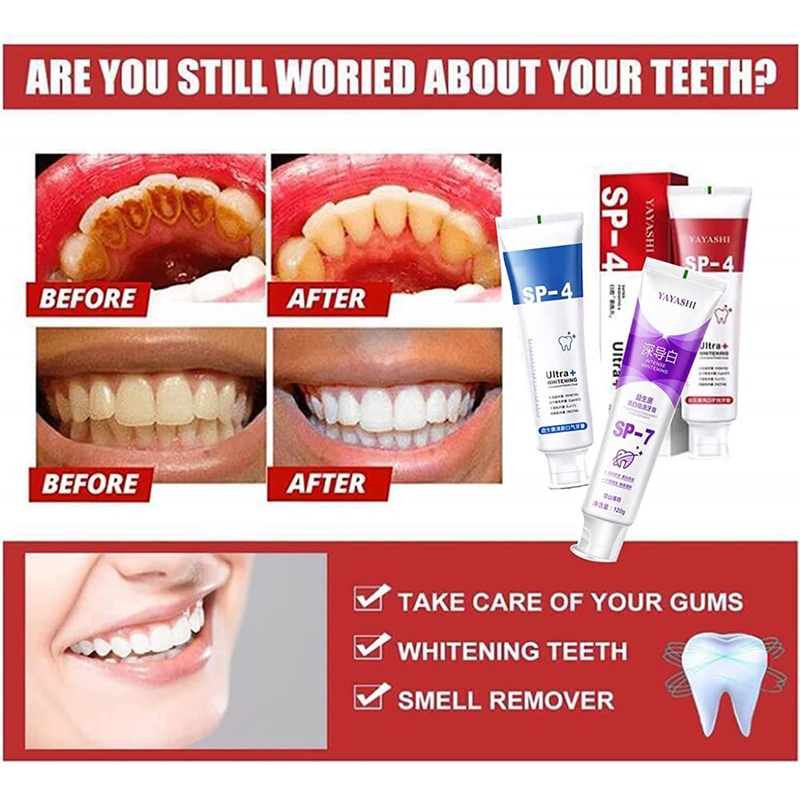 Kem đánh răng sp-4, kem đánh răng làm sáng sp-4 kem đánh răng fresh breath, kem đánh răng yayashi sp-4 probiotic, cải thiện vết răng màu vàng gói gia đình unisex yr