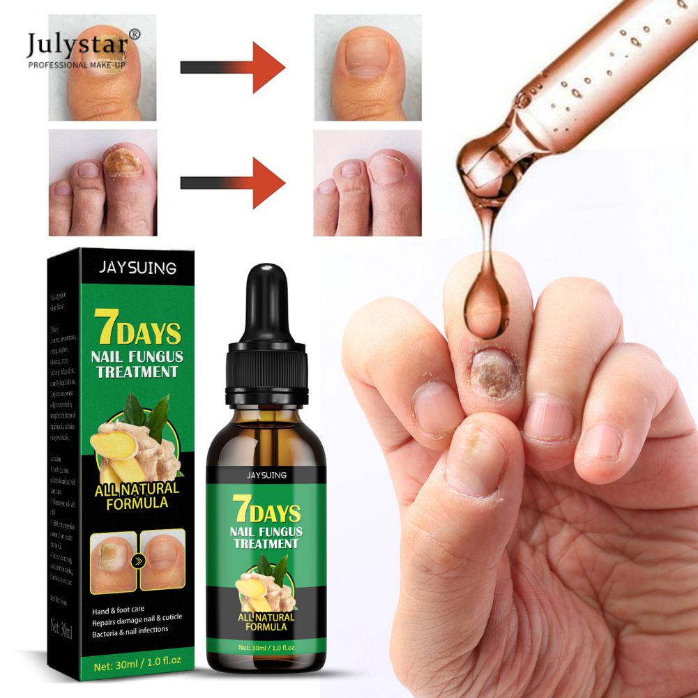 Tinh chất gừng 7 ngày JULYSTAR giúp phục hồi/ giảm nấm/ chống nhiễm trùng dưỡng ẩm chăm sóc cho móng 30ml