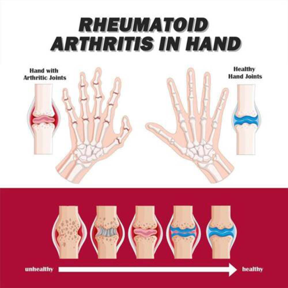 4Pcs Perfectx Joint & Bone Therapy Cream, Natural Joint & Bone Therapy Cream 30g