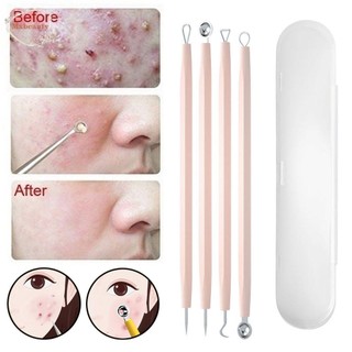[Hàng mới về] Mxbeauty Bộ Dụng Cụ Nặn Mụn Đầu Đen Bằng Thép Không Gỉ Tiện Lợi