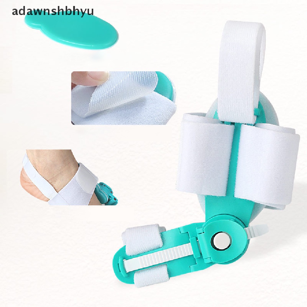 1 Dụng Cụ Nẹp Điều Chỉnh Ngón Chân Cái Bunion