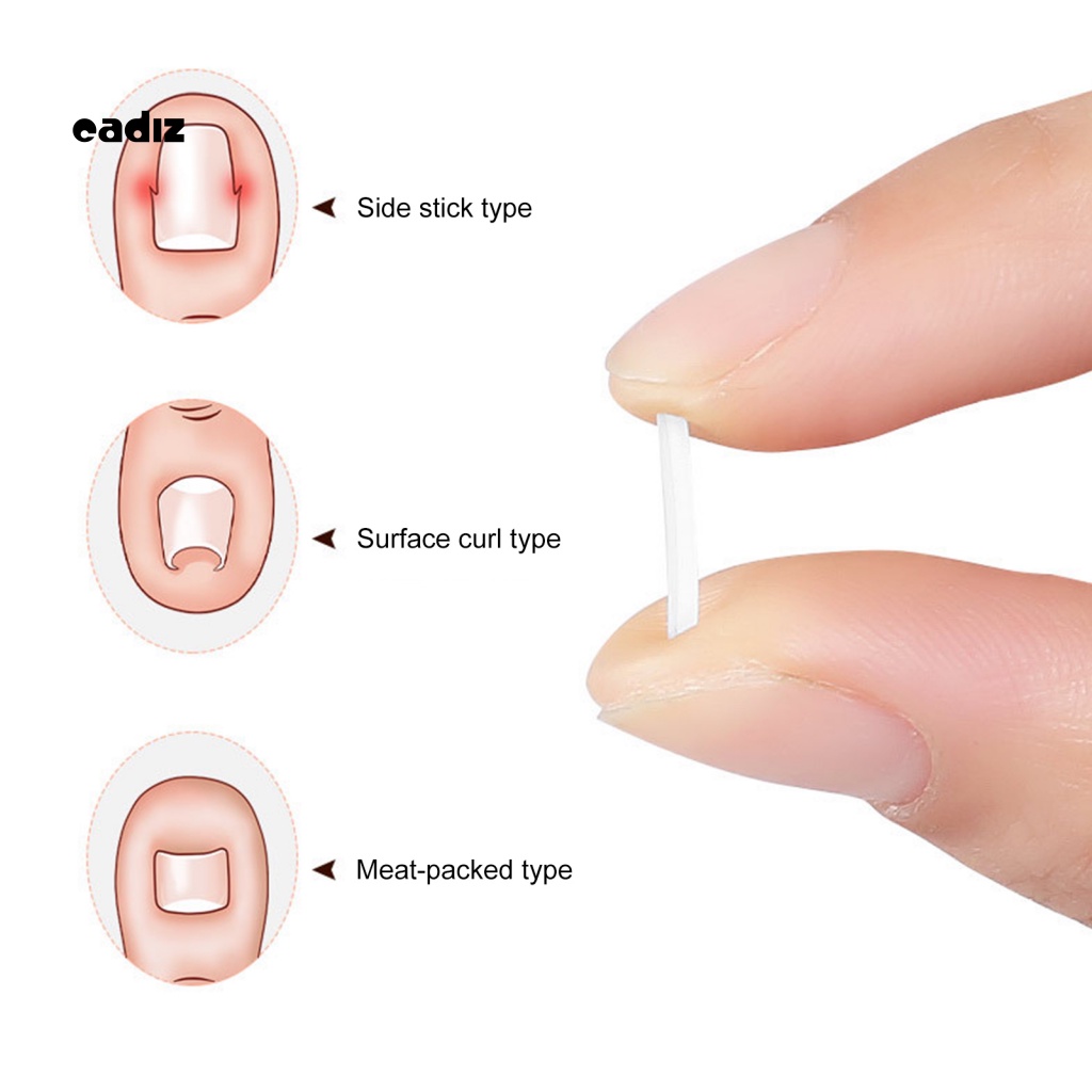 Set 10 Miếng Dán Chỉnh Sửa Móng Chân Tiện Dụng