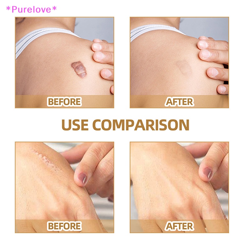 Set 60 Miếng Dán Che Khuyết Điểm Hình Xăm Chống Nước Tiện Dụng Mới