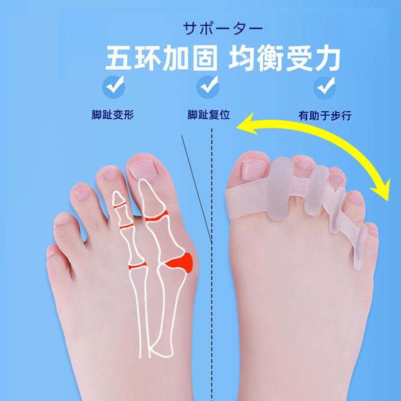 Dụng Cụ Tách Ngón Chân Cái Chuyên Dụng